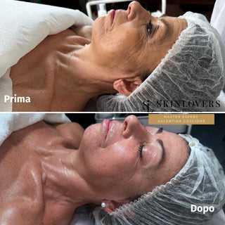 Il collagene marino è l’ingrediente beauty trend del 2025 per l’estetica avanzata