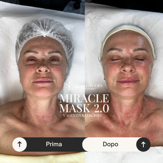 arrivano-i-patch-personalizzabili-per-il-viso-tutto-su-miracle-mask-2-0-by-skin-lovers-skin-lovers-cosmetics